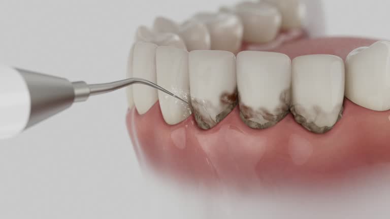 Trusted Tooth Extraction service in Macon, MO - Dentist Open Now